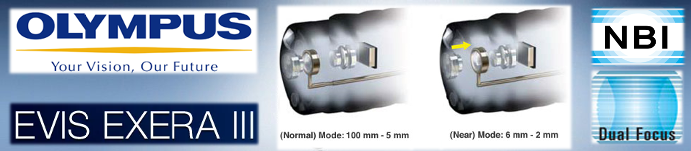 OLYMPUS, NBI, Колоноскопия, ФКС, эндоскопия кишки, Алексей Корнеев, лучший врач, лучший эндоскопист, полипы кишки, удаление полипов, рак кишки, подготовка кишки, боль в животе OLYMPUS, NBI, Колоноскопия, ФКС, эндоскопия кишки, Алексей Корнеев, лучший врач, лучший эндоскопист, полипы кишки, удаление полипов, рак кишки, подготовка кишки, боль в животе