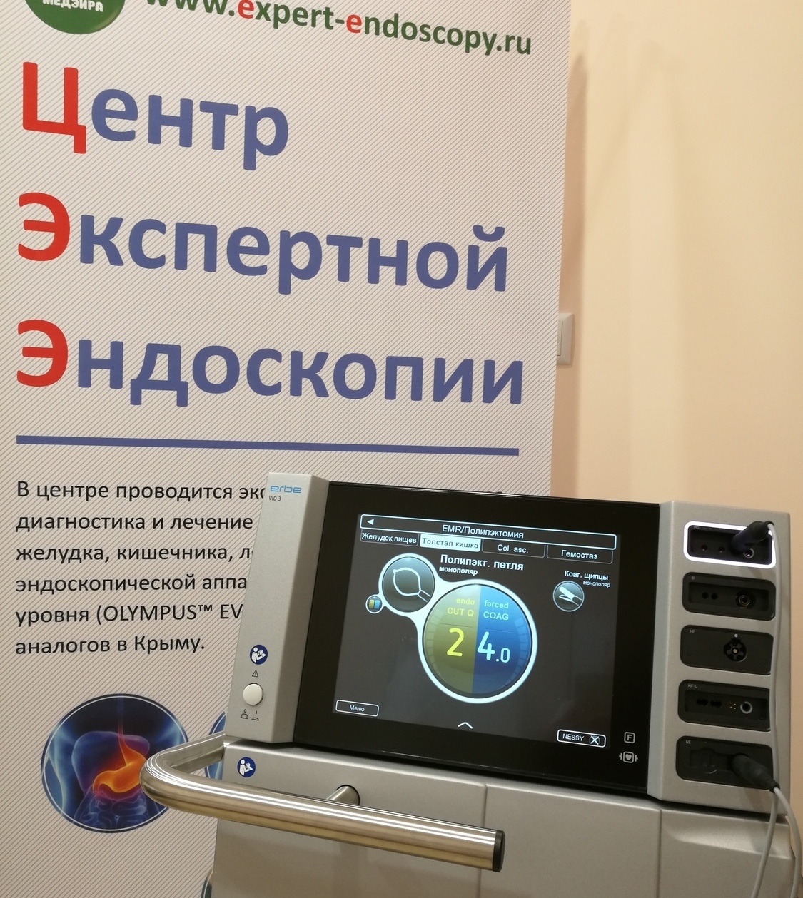 Полипэктомия, Удаление полипов, Стентирование ERBE 300D, Алексей Корнеев Полипэктомия, Удаление полипов, Стентирование ERBE 300D, Алексей Корнеев, лучшая аппаратура, лучший врач