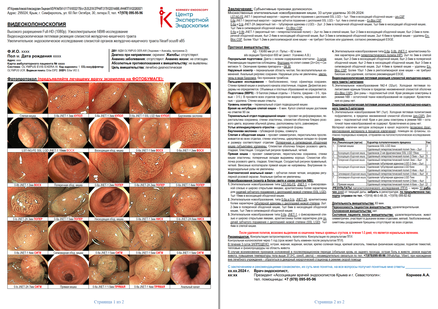 Протокол распечатан на фотобумаге в высоком разрешении Экспертная видео колоноскопия. Составленный врачом эндоскопистом экспертом протокол, с детальным фотоотчетом, каждая фотография выполнена прицельно, подписана. Заключение составлено в соответствии с актуальными международными классификациями.